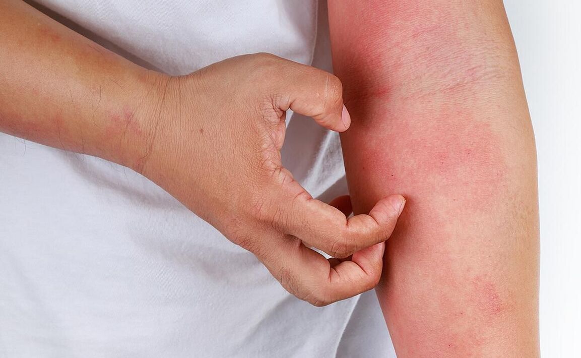 ソーダの使用により起こり得る合併症